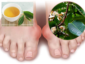 Lá vối chữa bệnh gút (gout) có tốt không? Hiệu quả như thế nào?